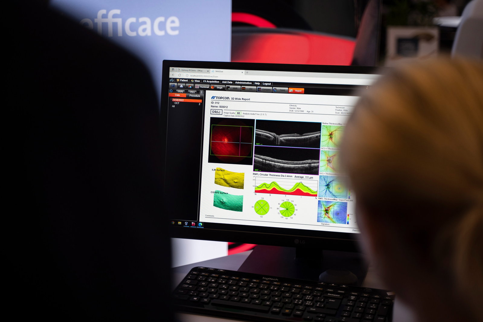 Mediconsult Academy | OCT-Anwenderkurs für MPAs