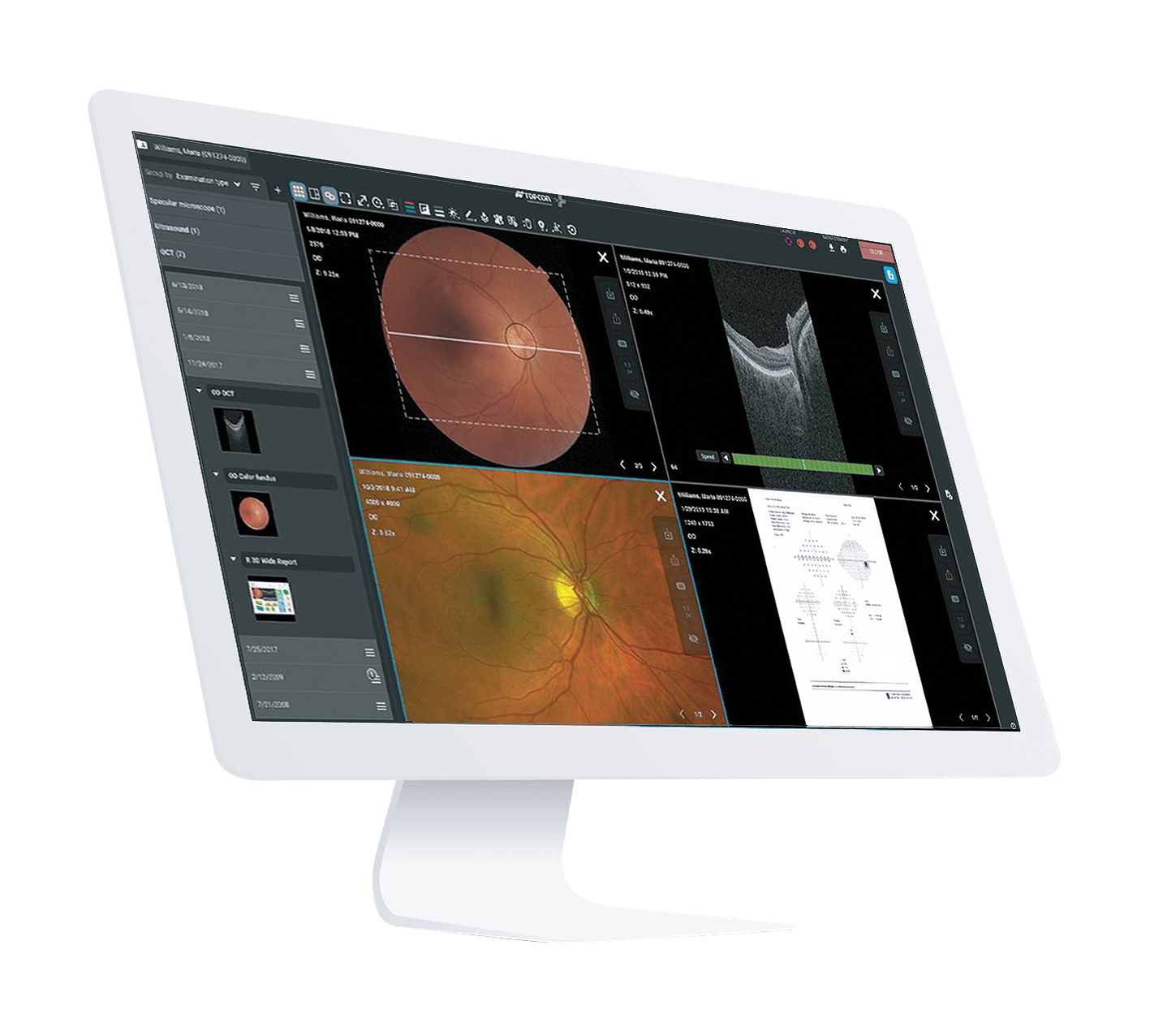 Diagnose & Refraktion Software & Analysetools